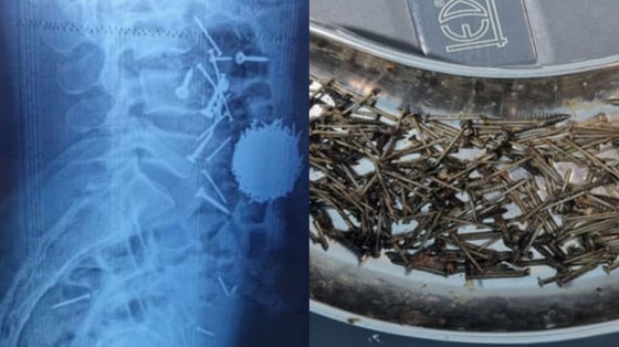 Фото:&nbsp;t.me/RSHTYIMSF