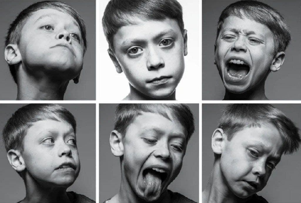 Психиатр рассказал о том самом синдроме Туретта, которым болеет Билли Айлиш