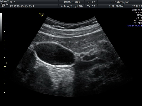  Узбекский специалист рассказала о том, как проявляется застой желчи