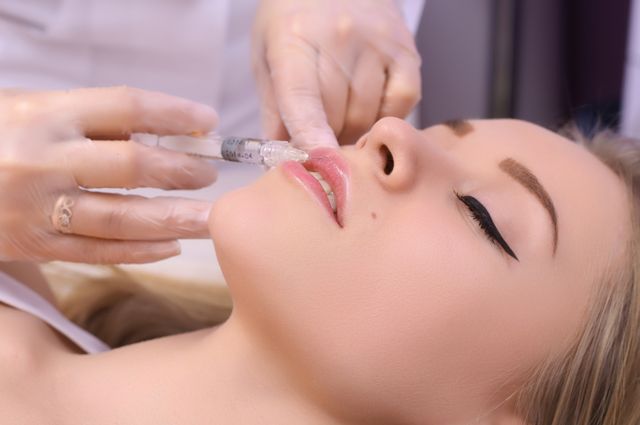 Филлеры: вся важная информация о процедуре