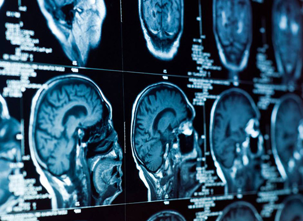 Ученые из России разработали датчик, который поможет исследовать мозг человека