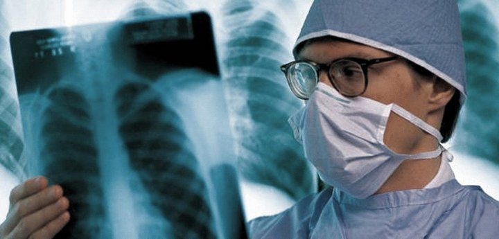 Минздрав опубликовал данные по выявленным случаям пневмонии: скончались три пациента