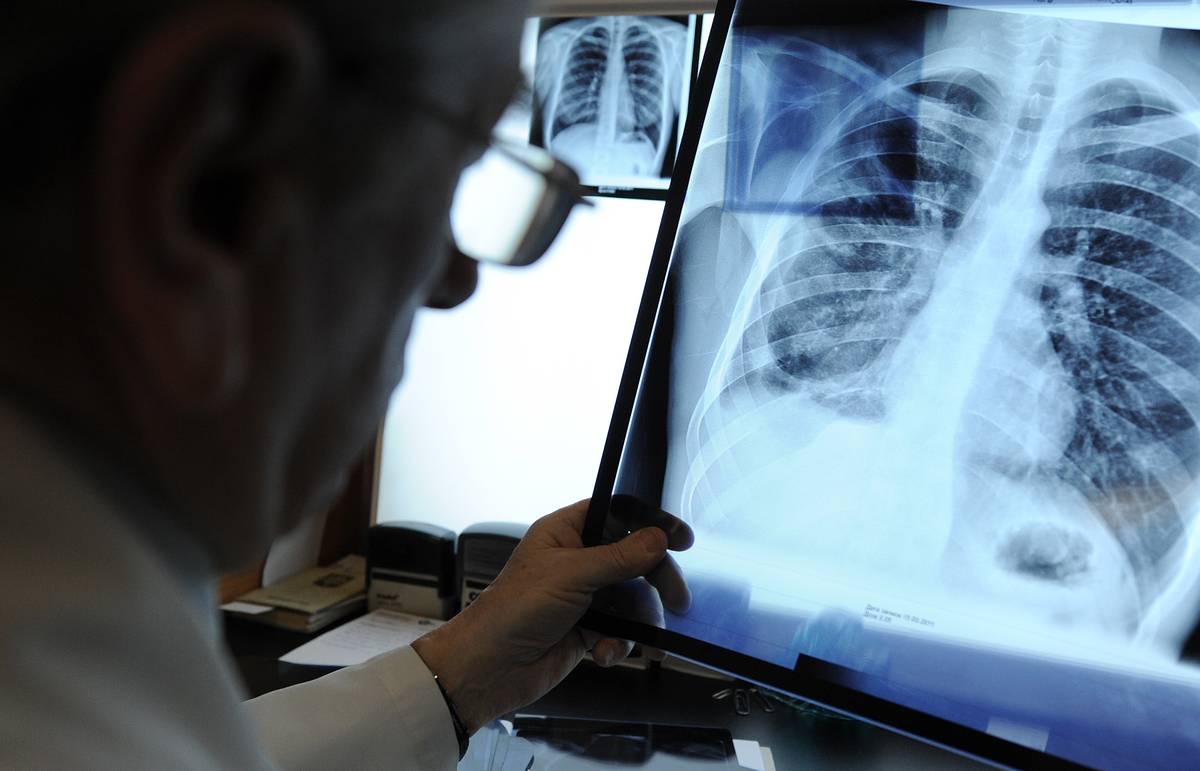 В Узбекистане за сутки выявлено сотни зараженных пневмонией