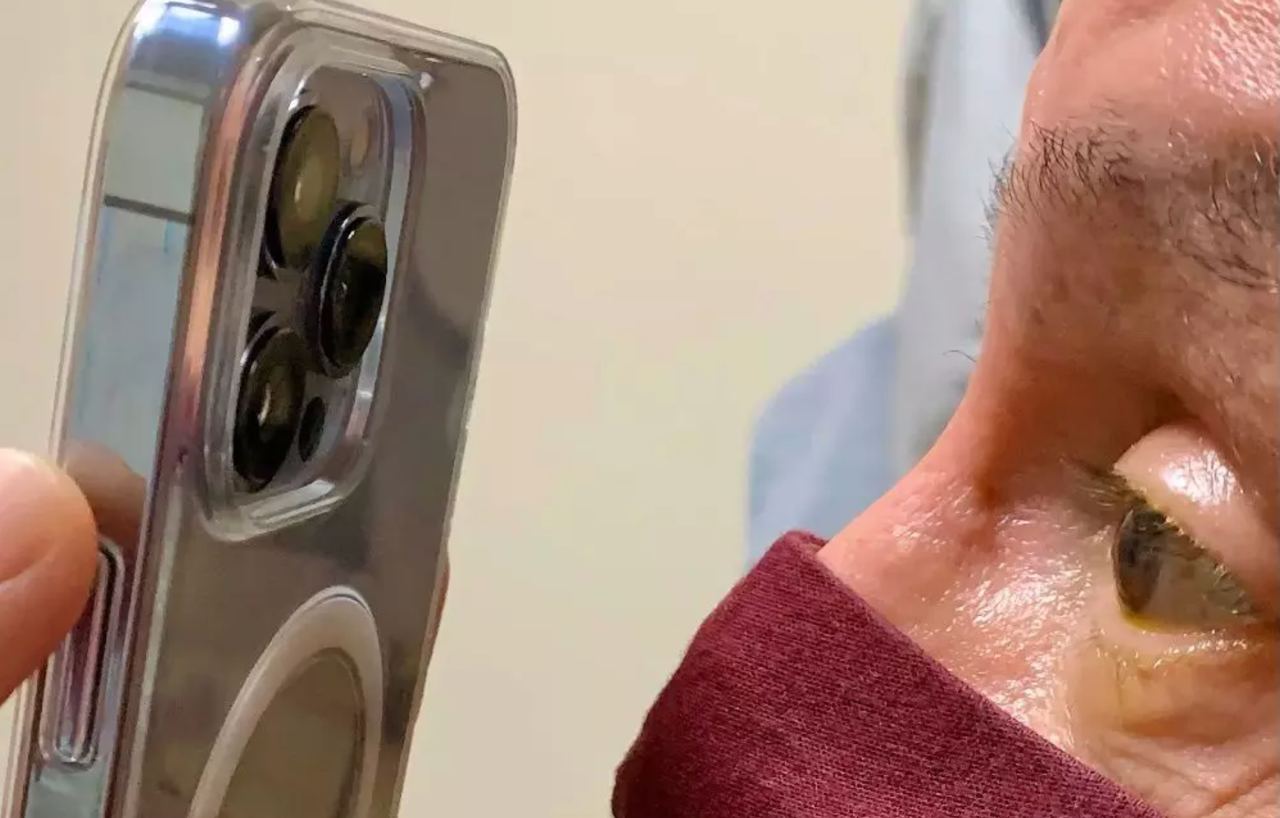 Врач стал использовать камеру на iPhone, вместо микроскопа, для лечения пациентов