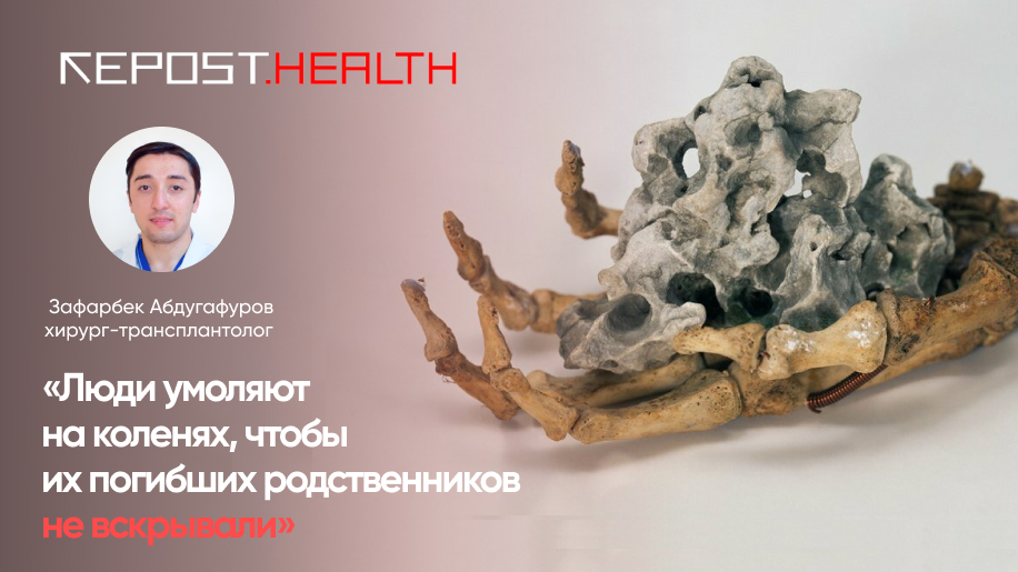 «Люди умоляют на коленях, чтобы их погибших родственников не вскрывали», — хирург-трансплантолог из Узбекистана рассказал о том, что мешает узаконить трупное донорство в нашей стране