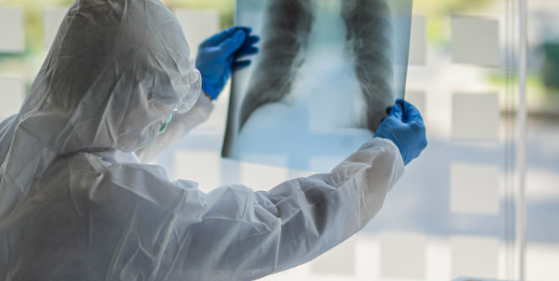 Впервые за долгое время в Узбекистане не было выявлено случаев инфицирования пневмонией — статистика