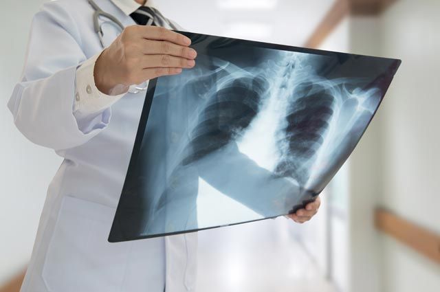 Стало ясно, сколько людей в Узбекистане болеют пневмонией — статистика