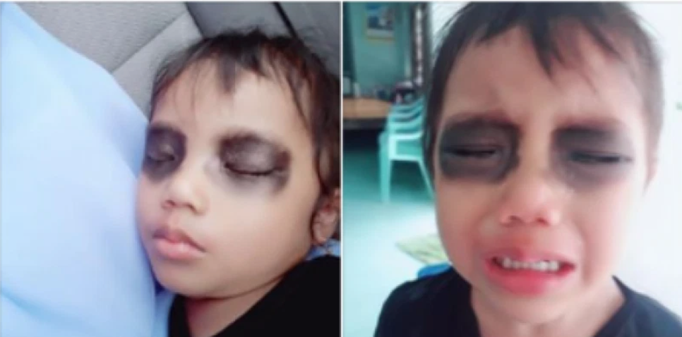 В Таиланде мать нашла отличный способ избавиться от телефономании ребенка — сработало безотказно