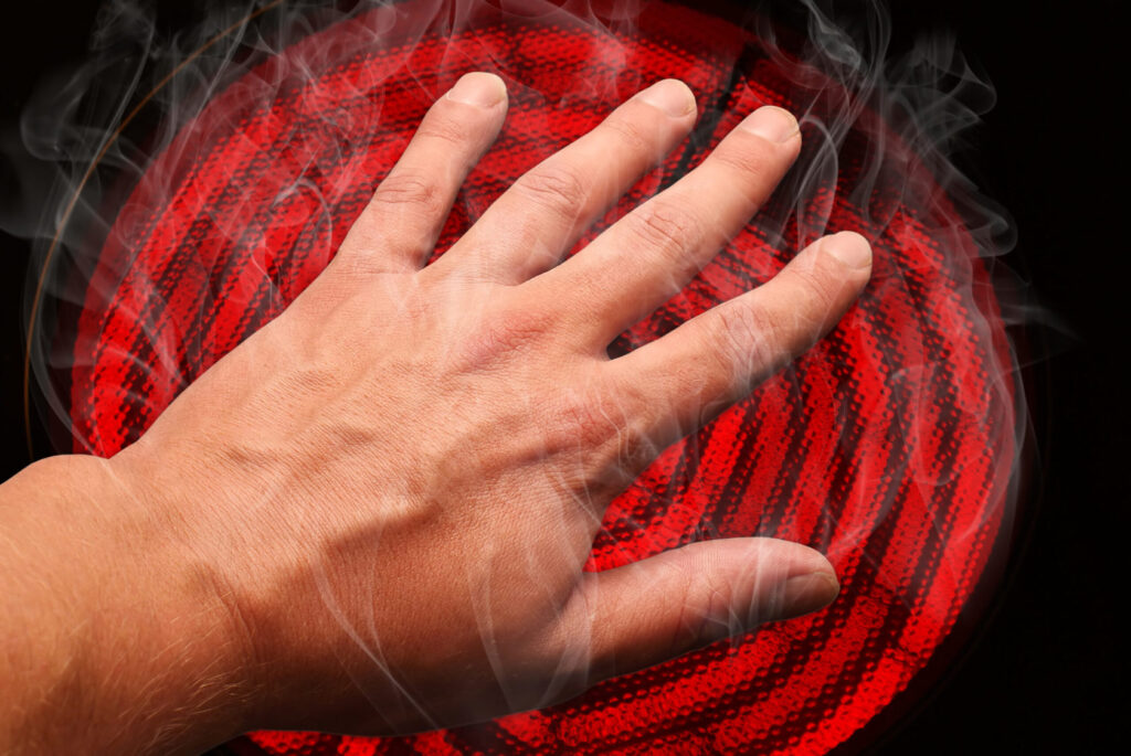 Как врачи определяют процент ожога тела — рассказываем