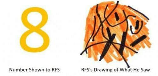 Узнайте о случае, когда после травмы мужчина перестал видеть некоторые цифры — видео