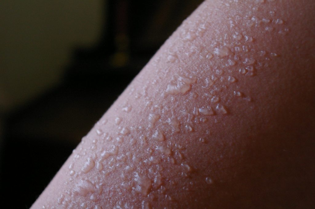 Женщина пожаловалась на сильнейшую аллергию на собственного ребенка