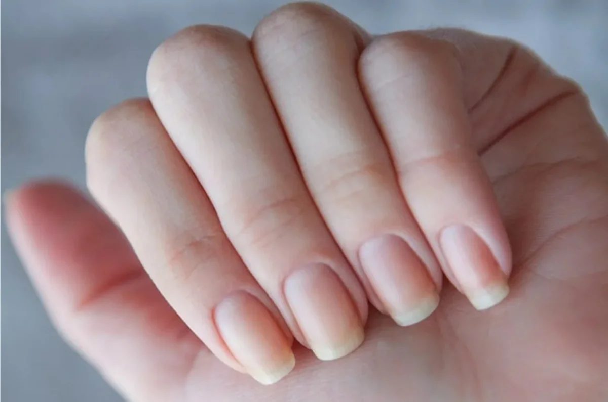 Диетолог рассказала, как определить дефицит витаминов по состоянию ногтей