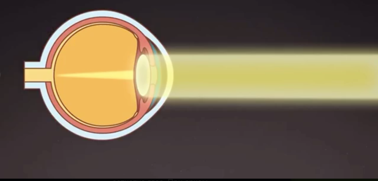 Что случается с глазом, когда мы смотрим на солнце?