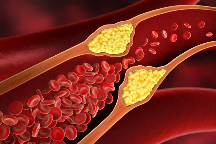 Как за пару секунд проверить здоровье сосудов