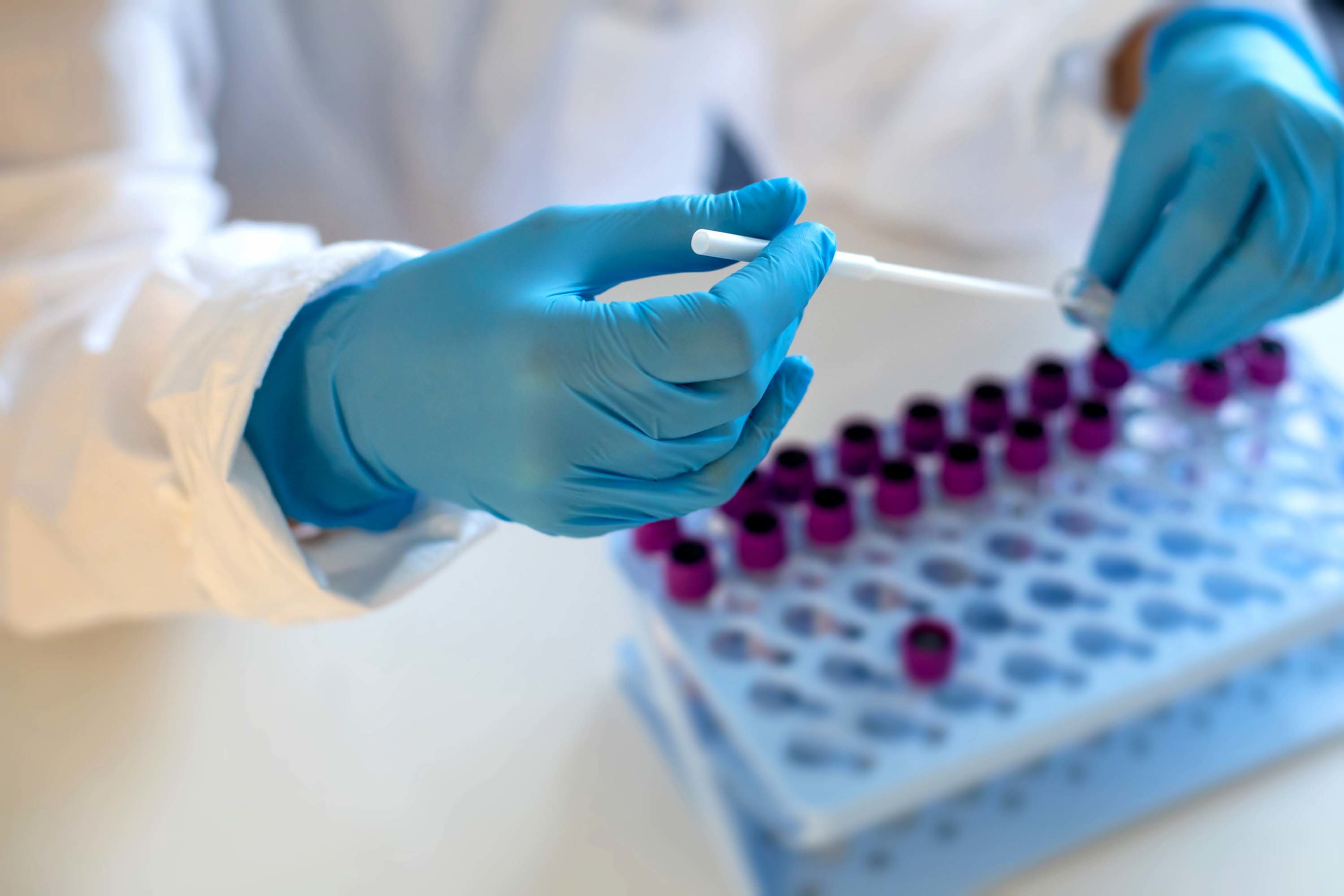 В России выявили первые случаи заражения штаммом «омикрон» – подробности