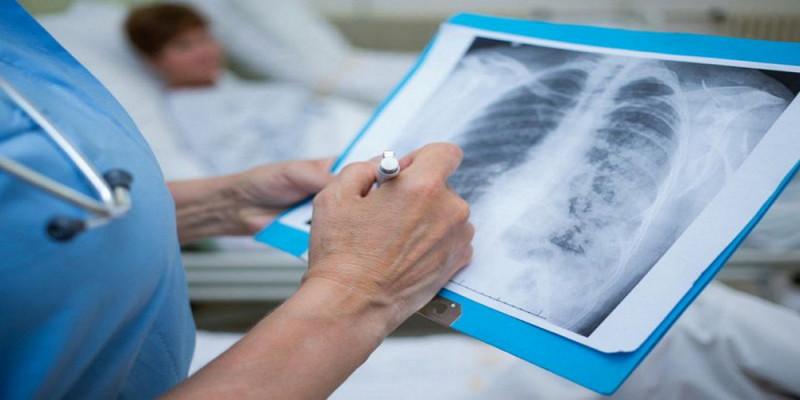 Узнали, сколько узбекистанцев заболели пневмонией за сутки