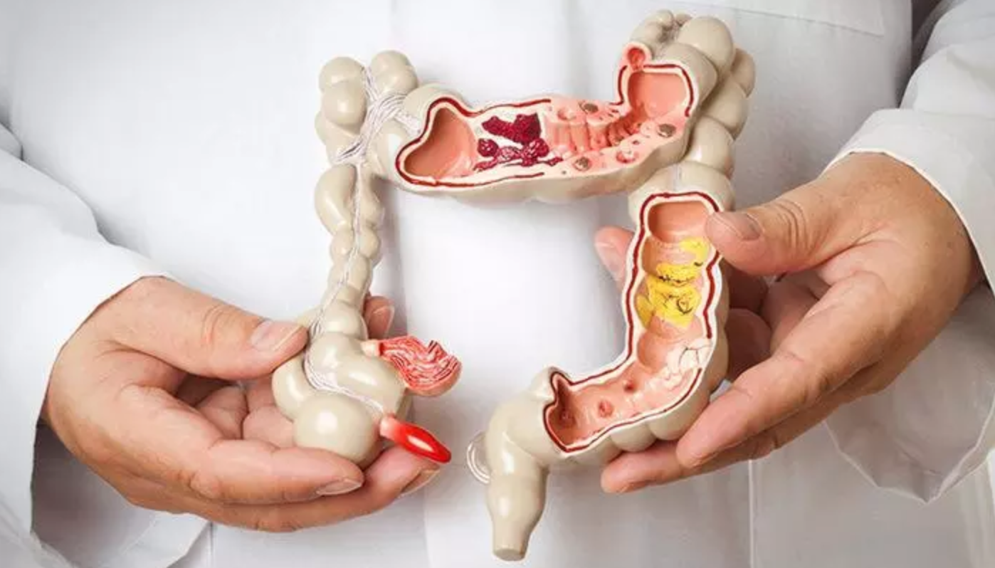 Ученые определили пользу аппендикса для здоровья