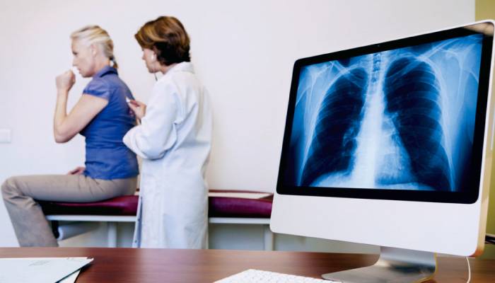 За прошедшие сутки в Узбекистане было выявлено более 90 случаев заражения пневмонией — статистика