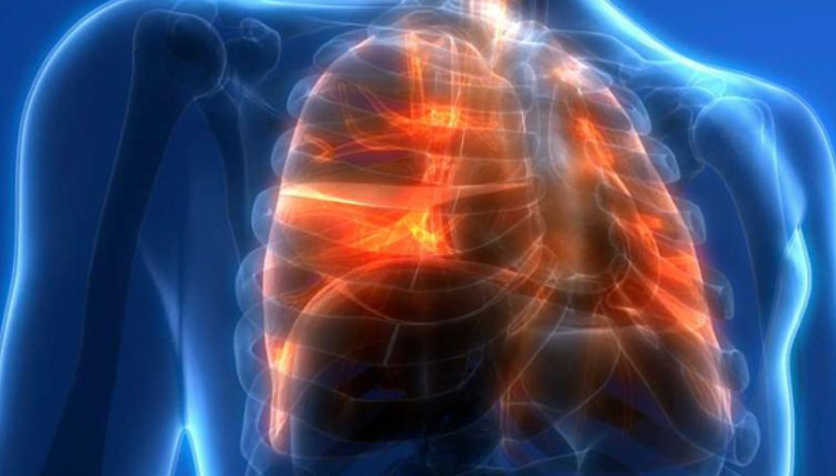 Можно ли восстановить легкие после многолетнего курения