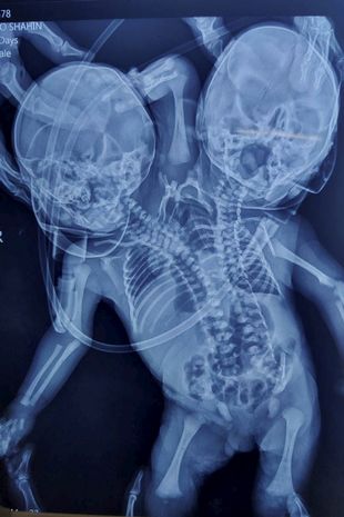 Фото: Rareshot News / SWNS