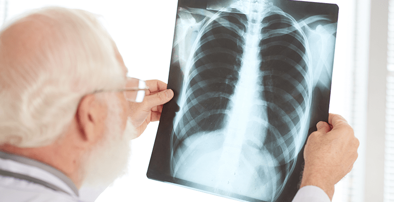 В Узбекистане за вчерашний день было зарегистрировано 23 новых случая заражения пневмонией  