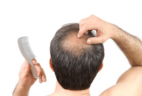 Эксперты рассказали о последствии коронавируса, которое меняет внешность