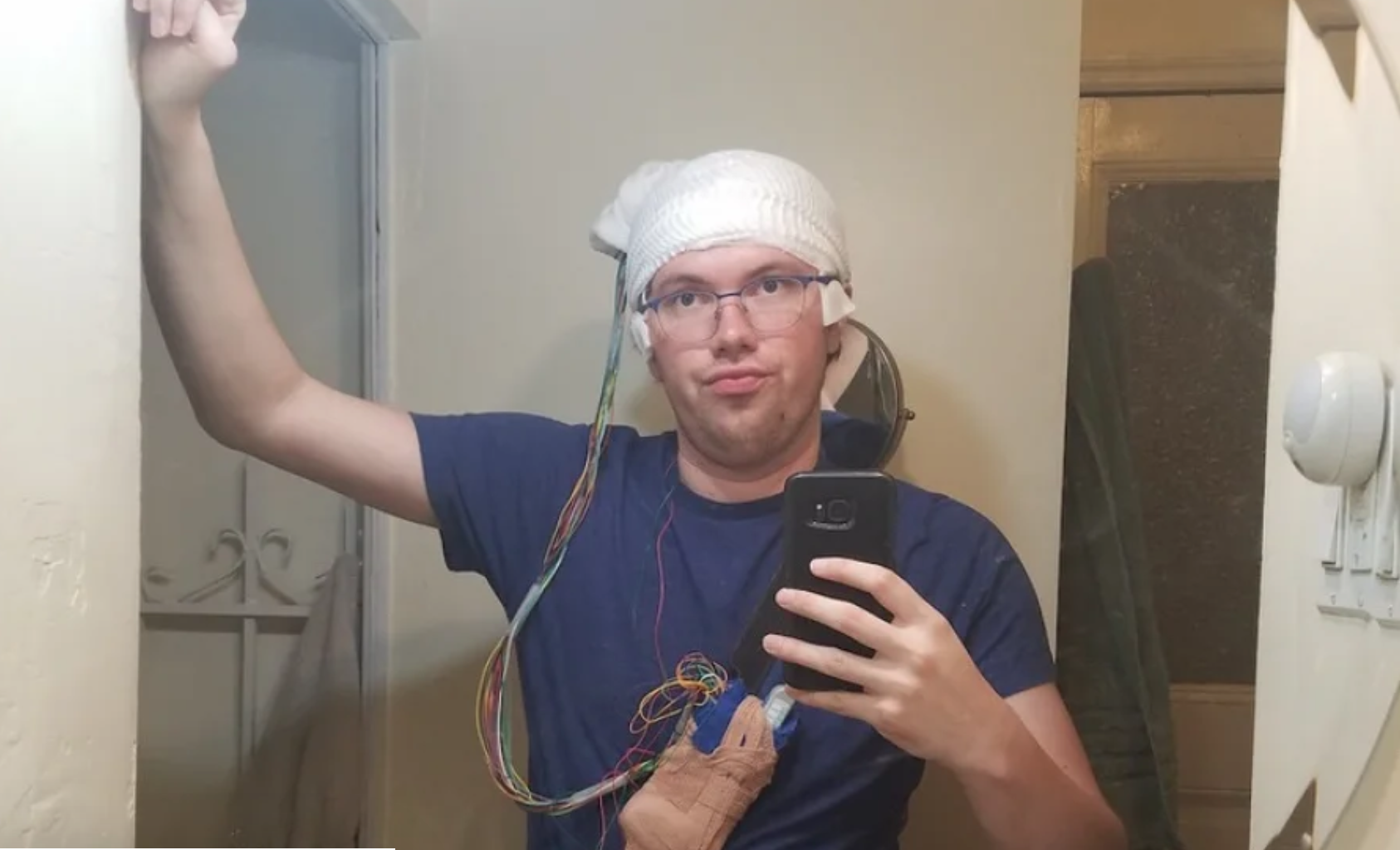 Мужчина из Нью-Йорка удалил часть мозга и стал бесстрашным 