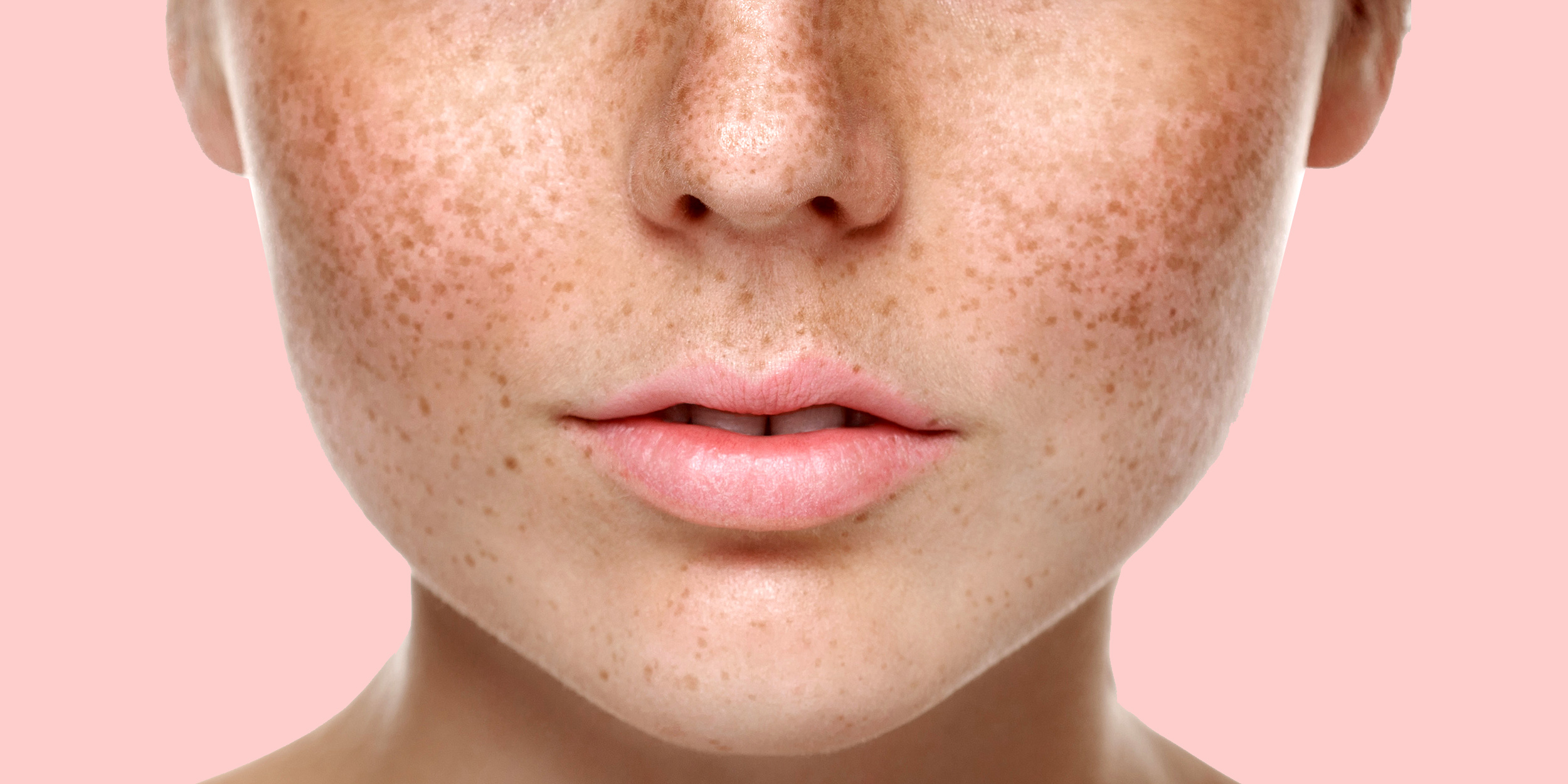 Узбекский терапевт объяснила, что такое пигментные пятна и какими они бывают