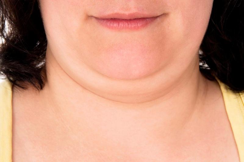 Диетолог рассказала, как избавиться от второго подбородка