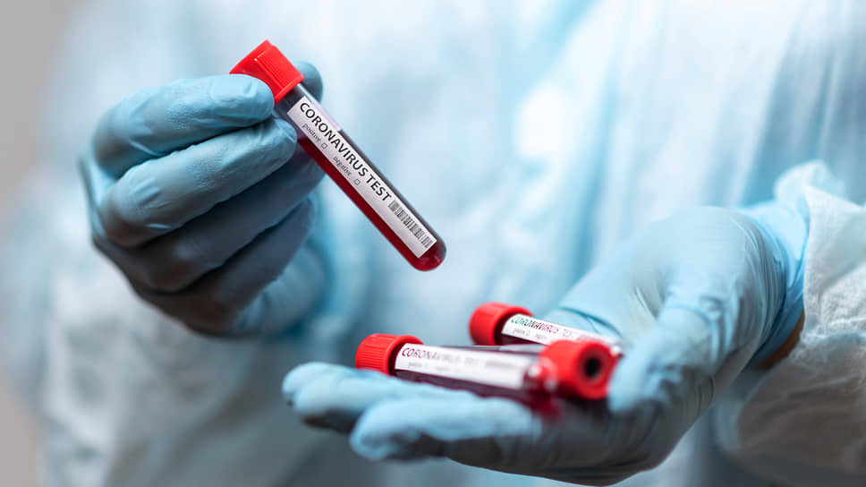 Число умерших от коронавируса в нашей стране достигло 670 человек