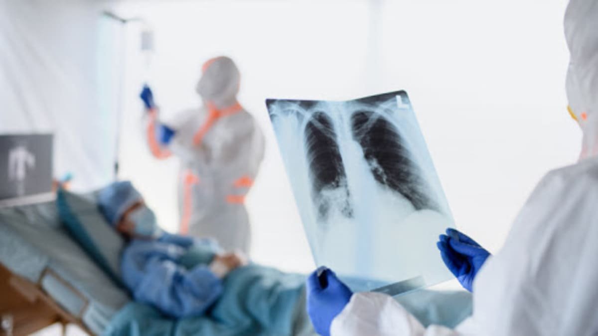 В Узбекистане за прошедшие сутки умерли еще 3 человека от пневмонии — статистика