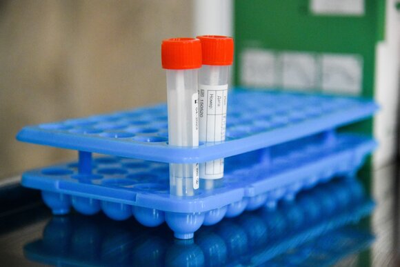 Гинцбург рассказал о вероятности вытеснения «дельта»-штамма «омикроном»