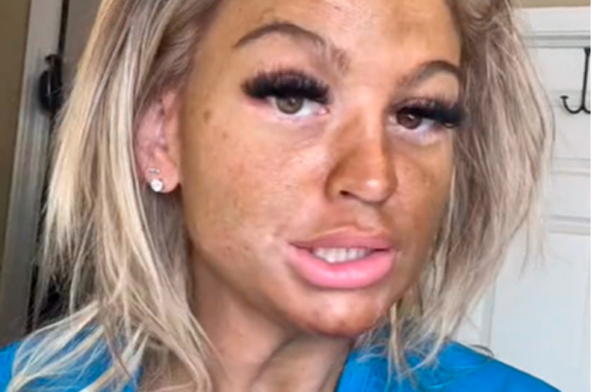 Блогер нанесла на лицо автозагар перед сном и и испугалась своего отражения