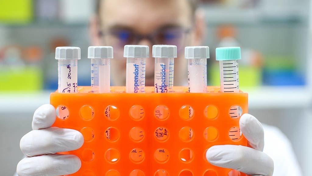 В Узбекистане в продажу поступил экспресс-тест, который можно использовать в домашних условиях