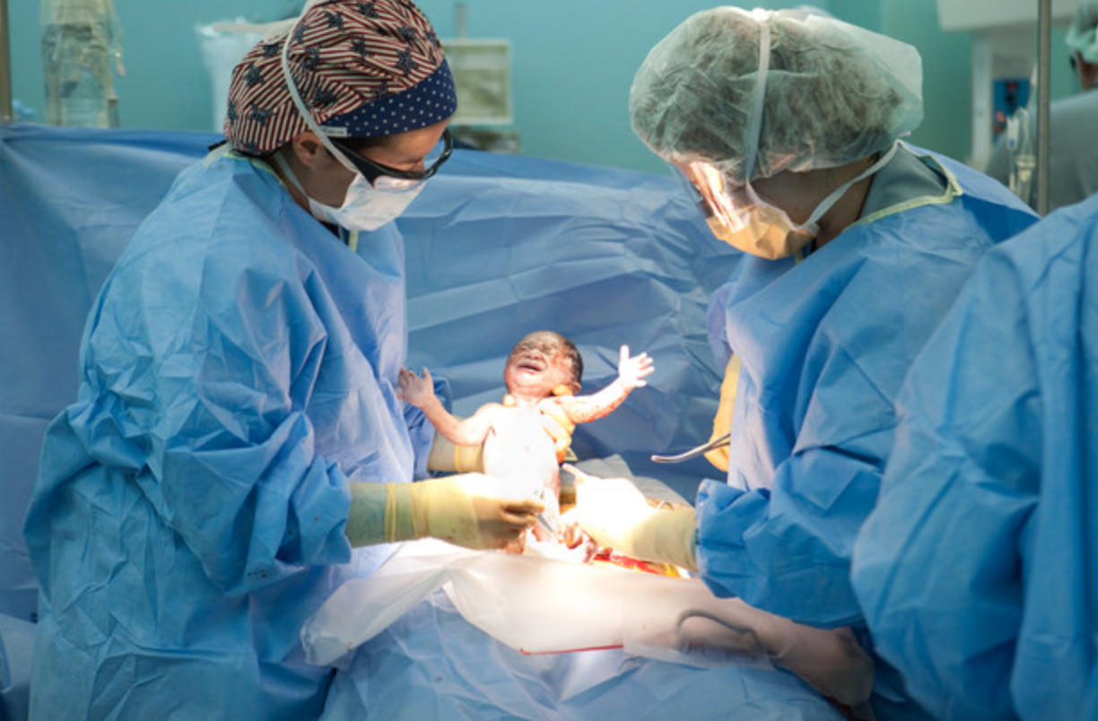 Узбекский гинеколог рассказала, как в древности проводилось кесарево сечение