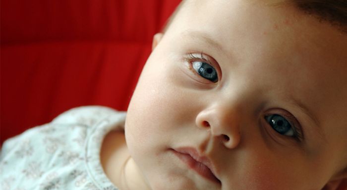 Почему у детей появляются темные круги под глазами?