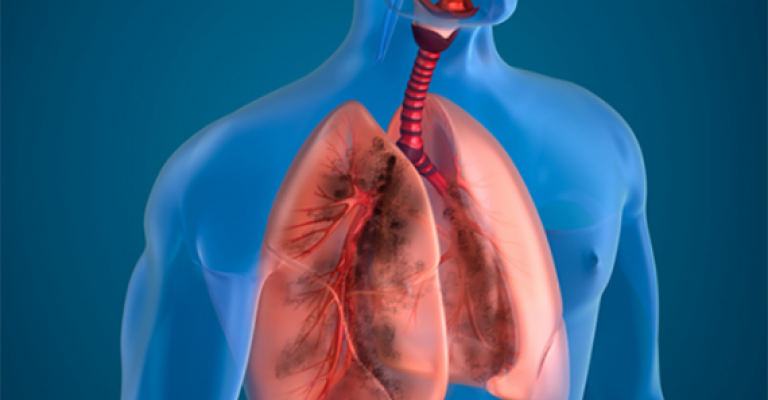 В Узбекистане практически перестали выявлять новые случаи заражения пневмонией — статистика