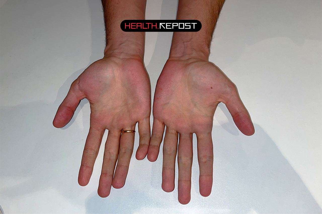 Почему кровь красная, а вены синие?