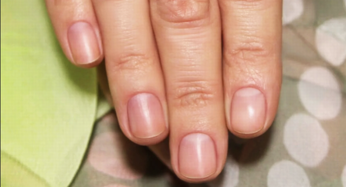 Почему, когда ногти растут, нам не больно