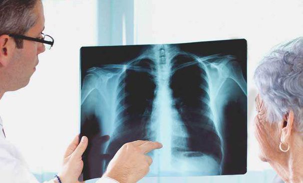 Сколько человек заразились пневмонией за вчерашние сутки в Узбекистане?