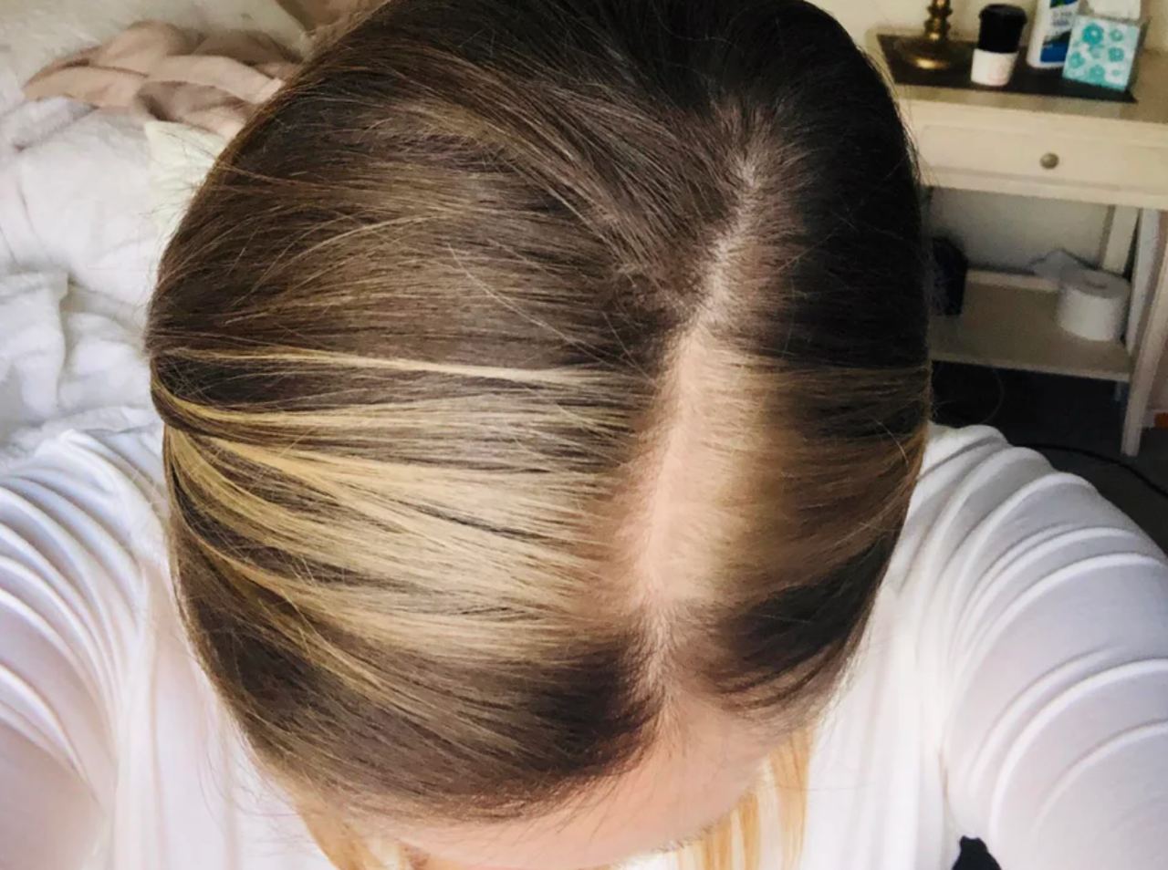 Жительница Англии родила ребенка с разноцветными волосами и ресницами — рассказываем, что это за диагноз и как с ним жить