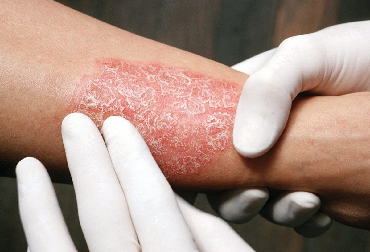 Фото: dermacenter.uz