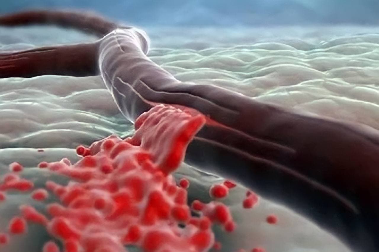 Специалист назвал четыре фактора, разрушающих сосуды