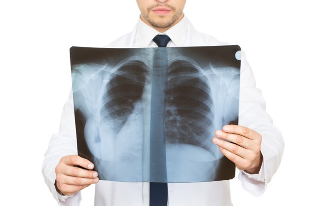 Ученые из Великобритании объяснили проблемы с дыханием после выздоровления от коронавируса