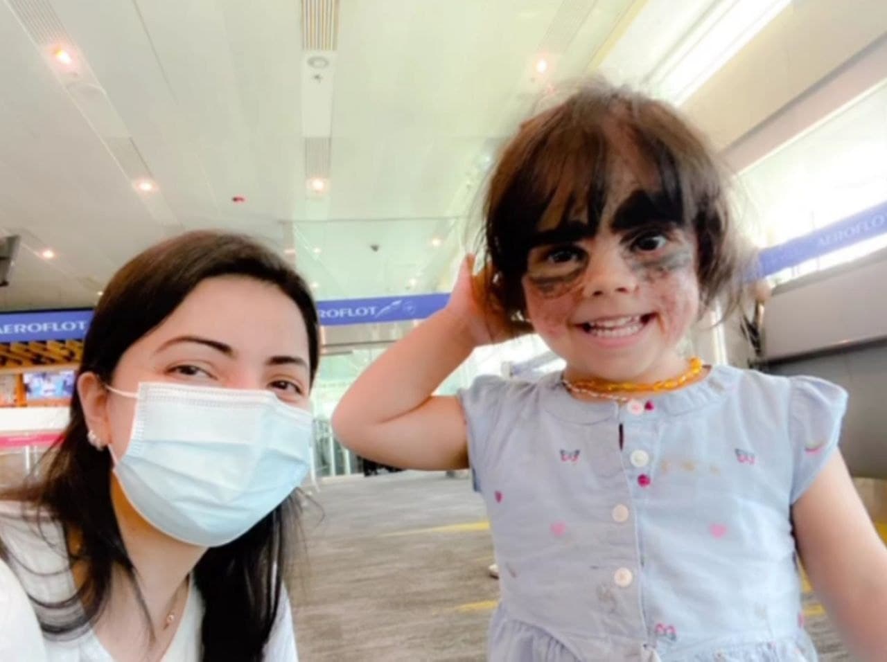 Фото после операции