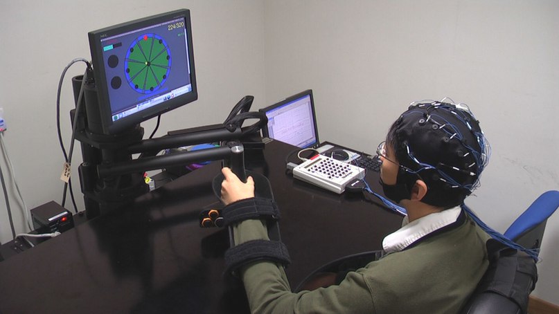 Ученые рассказали о том, что восстановление после инсульта может зависеть от доминирующей руки