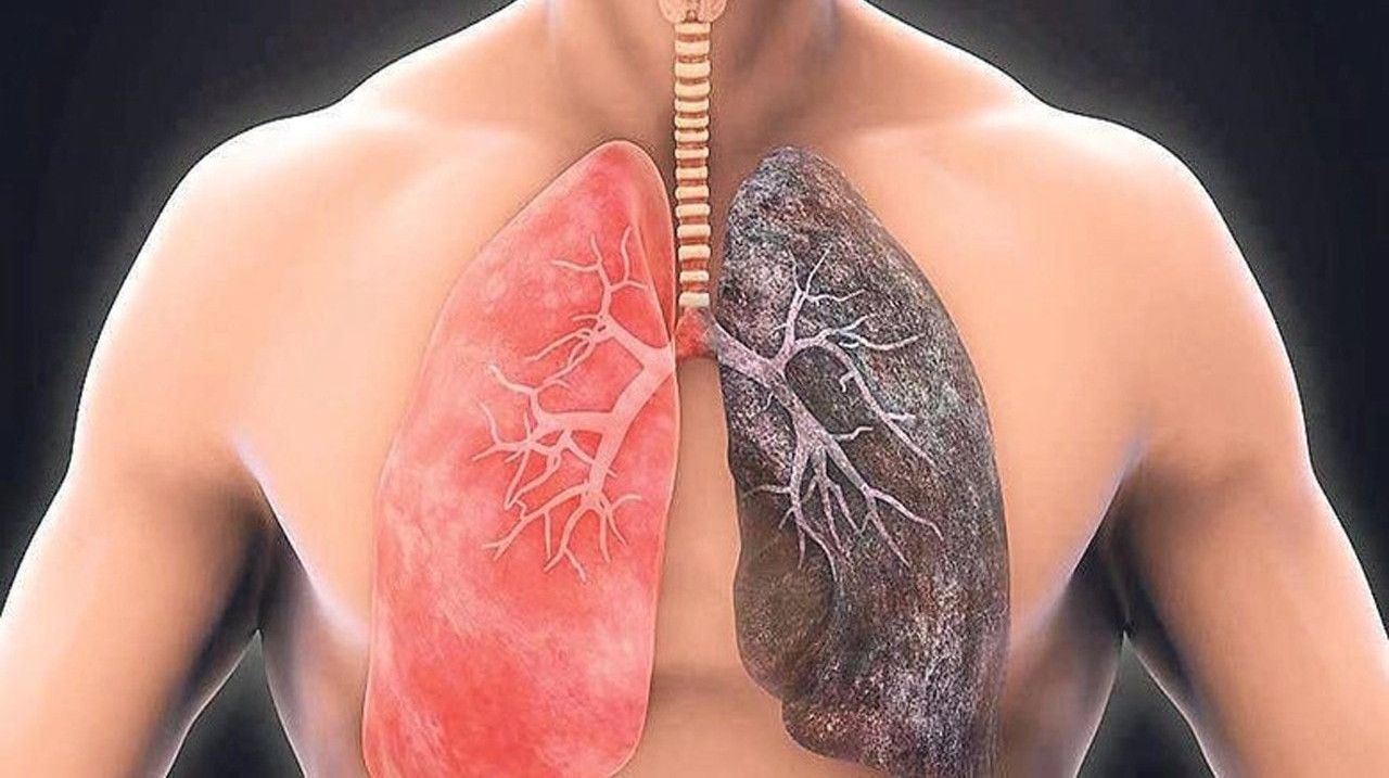 Могут ли заболевания легких передаваться по наследству: объясняет врач