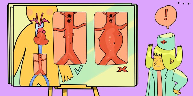 Чаще всего люди умирают, не подозревая о болезни: что такое аневризма аорты