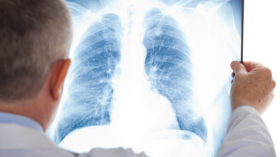 За прошедшие сутки у более 200 человек в Узбекистане была выявлена пневмония