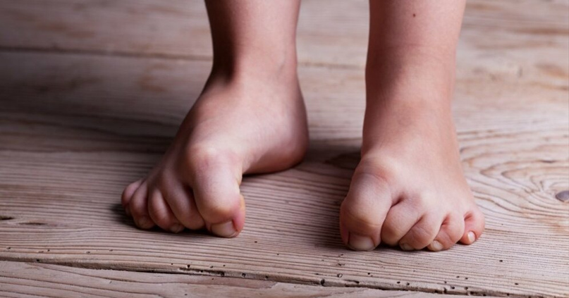 Как понять, грозит ли вам ампутация ног